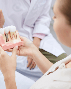 purentakisko vai hammassuoja ero