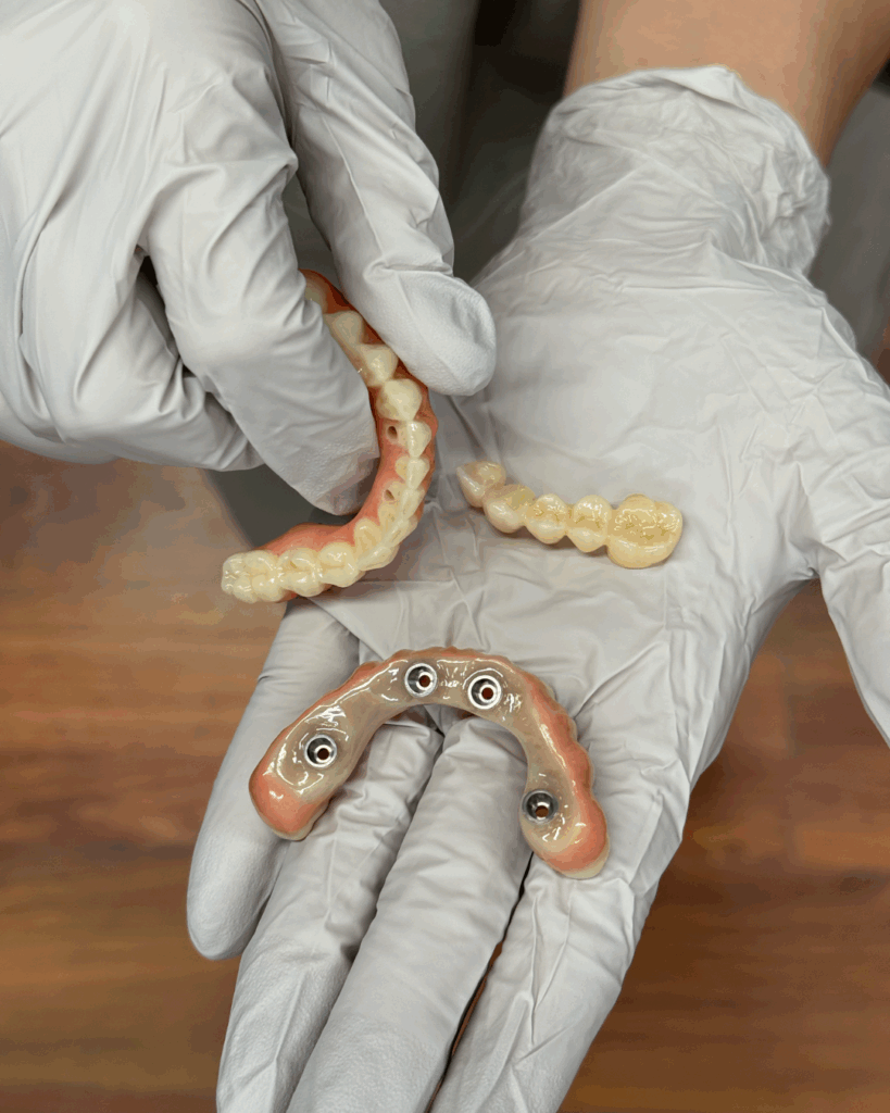 proteesin korjaus Helsinki