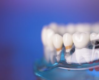 narskuttelukisko Helsinki