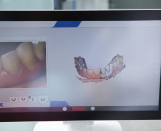 hammasproteesien korjaus Helsinki