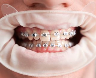 hammaslääkäri Helsinki